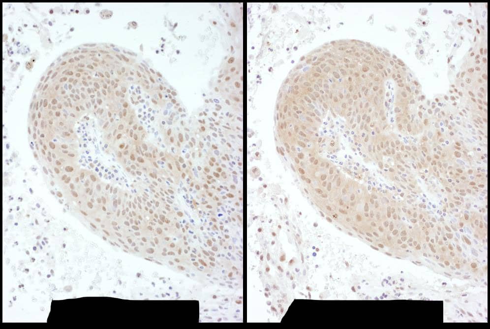 PSMC6 Antibody