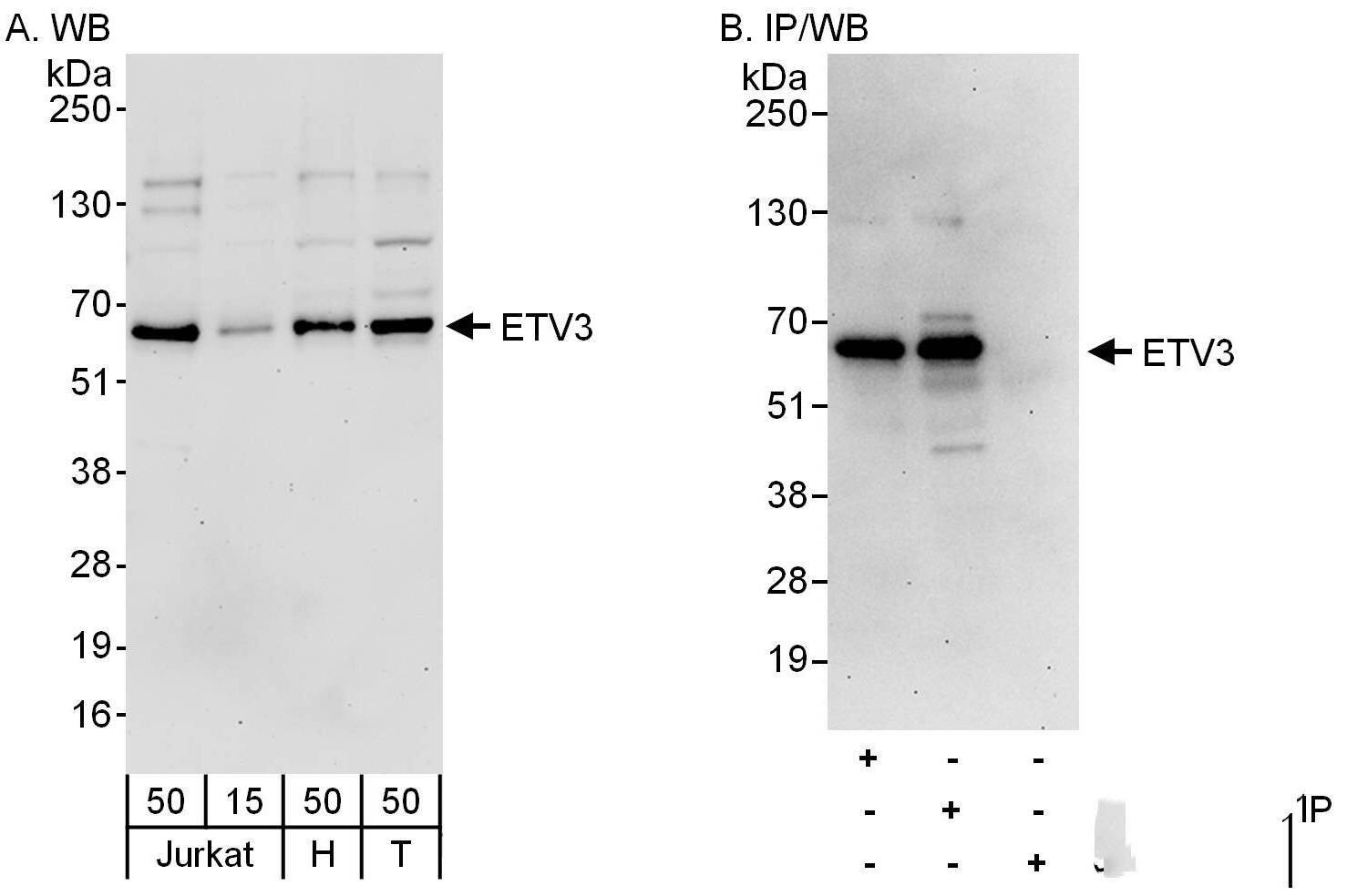 ETV3 Antibody