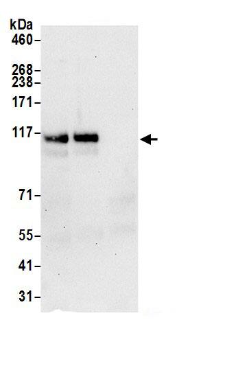 HIP1 Antibody