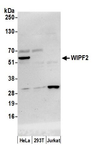 WIRE Antibody