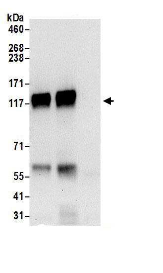 PLCL2 Antibody