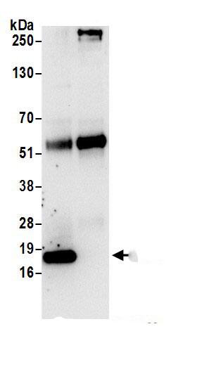 AP1S1 Antibody