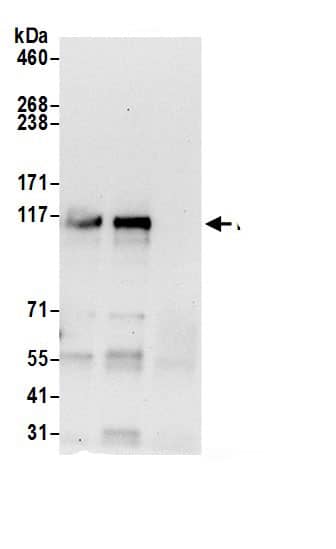 MSH3 Antibody