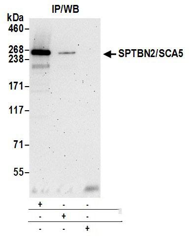 Spectrin beta 3 Antibody