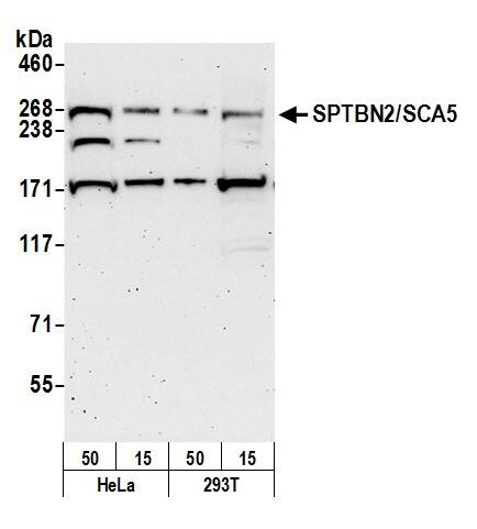 Spectrin beta 3 Antibody