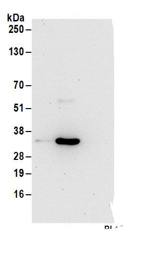 Purine Nucleoside Phosphorylase/PNP Antibody