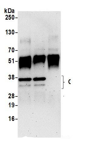 TFIIE beta Antibody