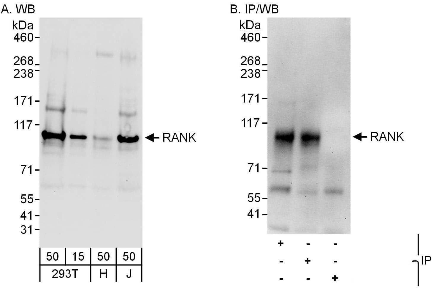 RANK/TNFRSF11A Antibody