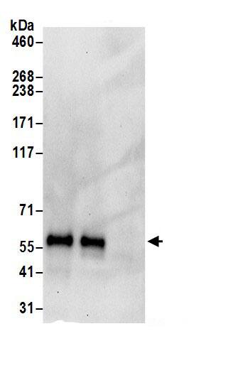 Lipolysis Stimulated Lipoprotein Receptor Antibody