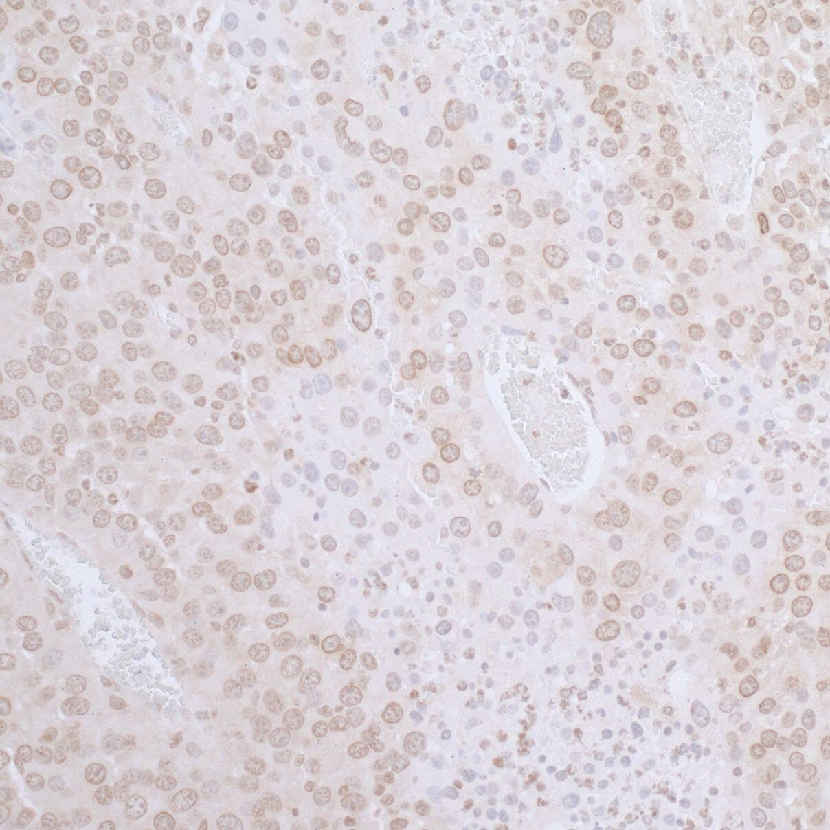 Thymopoietin/LAP2 Antibody