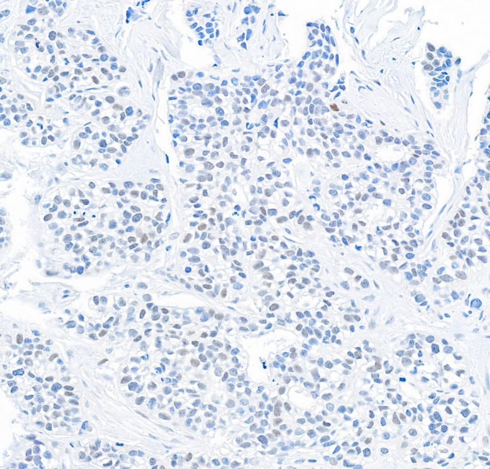 DEC1 Antibody