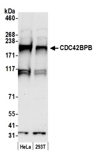 CDC42BPB Antibody