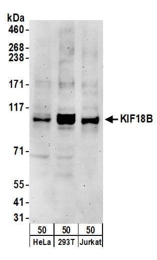 KIF18B Antibody