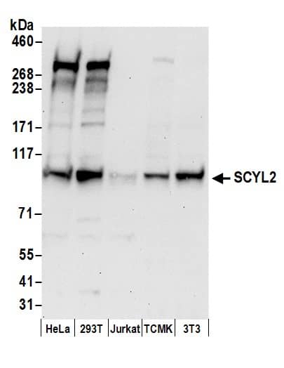 SCYL2 Antibody