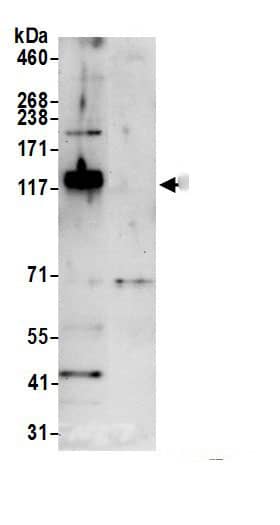 FNDC3A Antibody