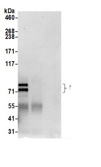 PALS1/MPP5 Antibody