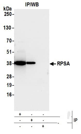 RPSA Antibody