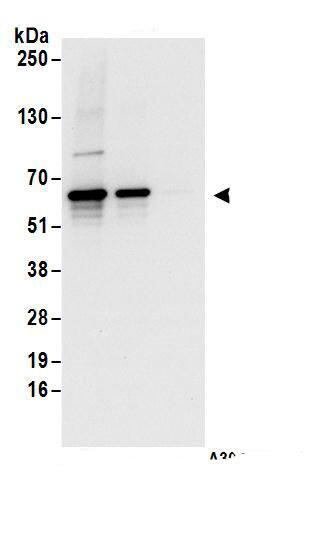 EDC3 Antibody