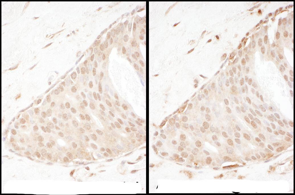 beta-Arrestin 2 Antibody