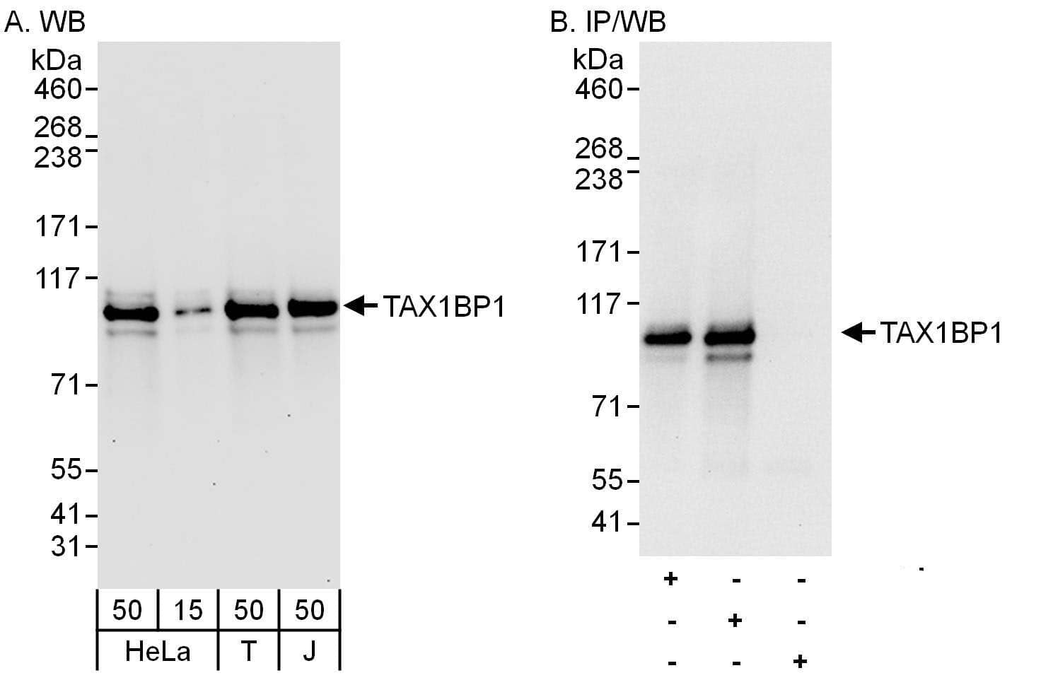 TAX1BP1 Antibody