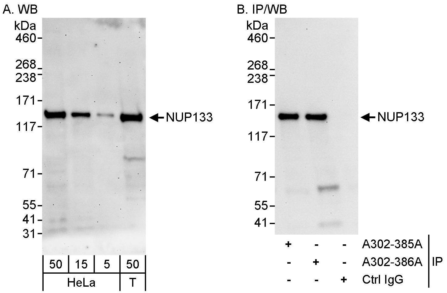 NUP133 Antibody