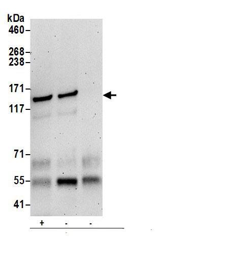VARS Antibody