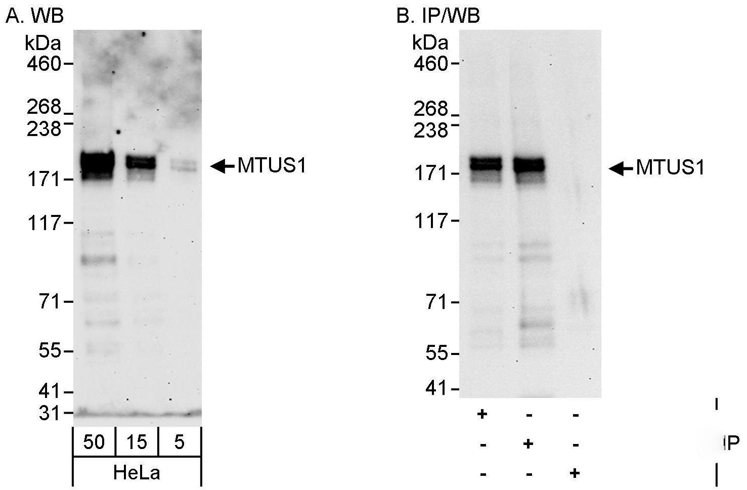 MTUS1 Antibody