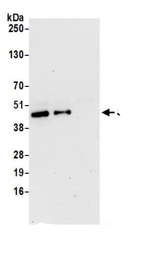 SUCLG2 Antibody