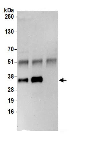 PPA2 Antibody