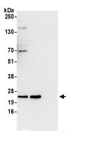 Biliverdin Reductase B/BLVRB Antibody