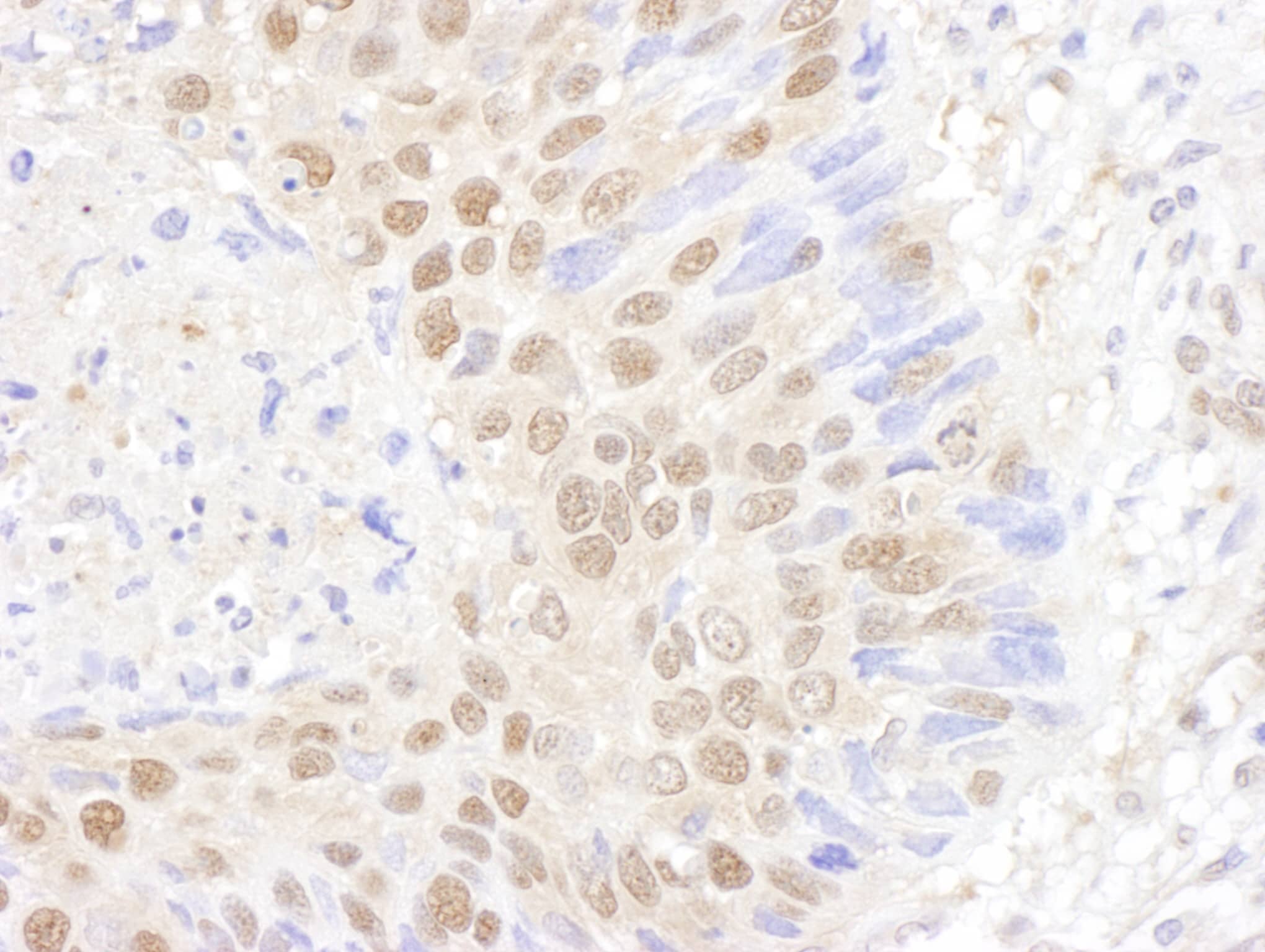 PSMB7 Antibody