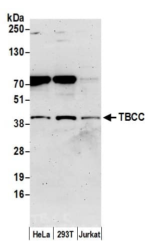 TBCC Antibody