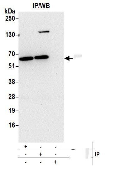 Catalase Antibody