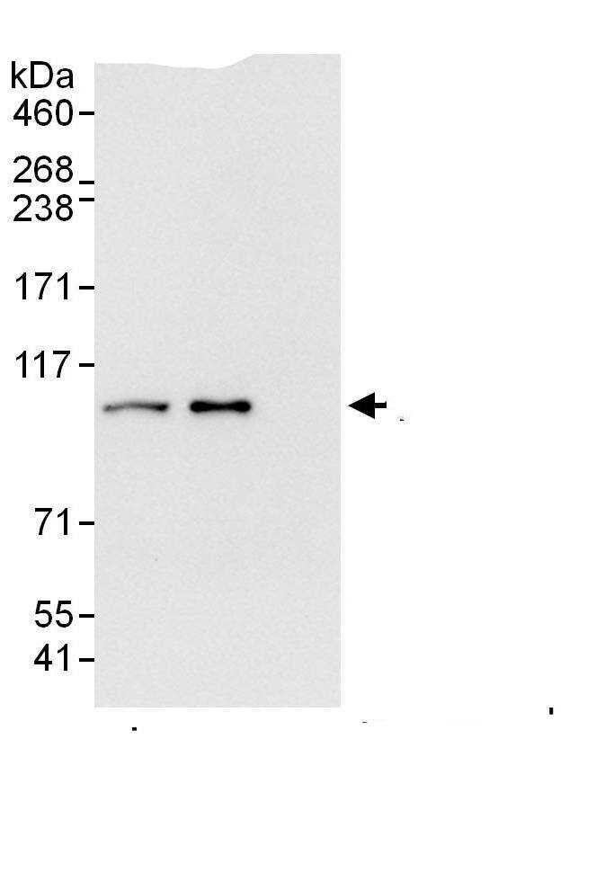 Proteasome 19S 10B Antibody