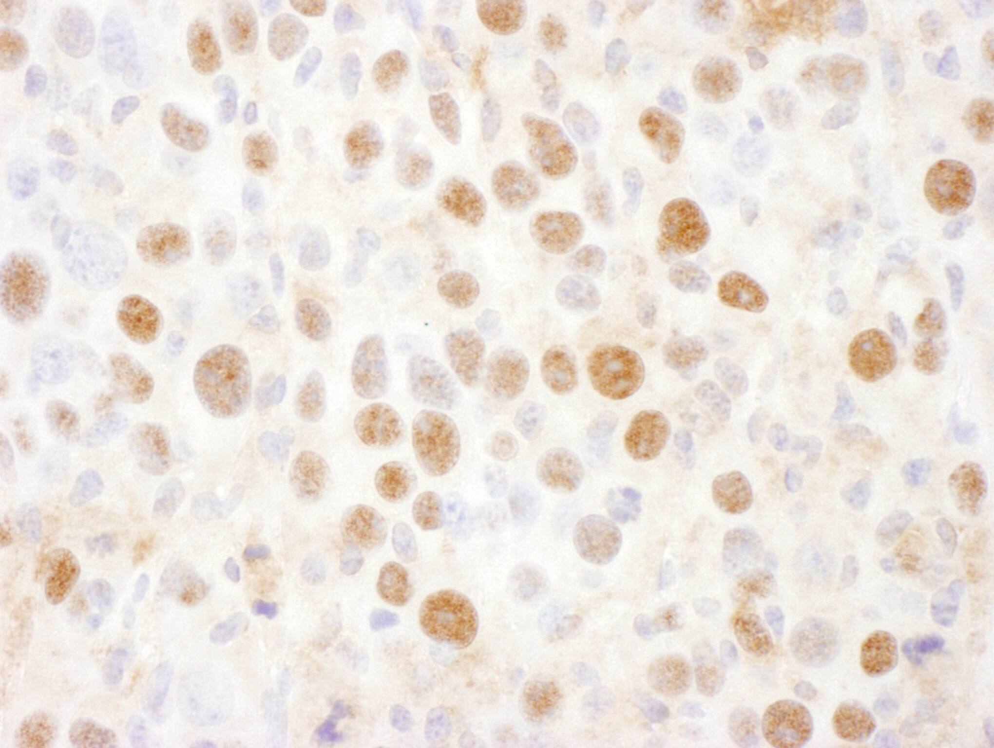 Proteasome 19S 10B Antibody