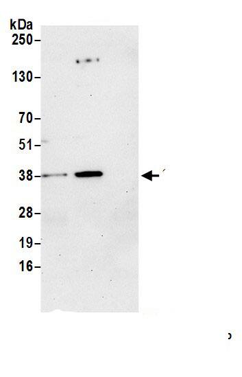 SGTB Antibody