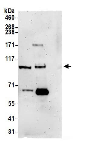 BRD3 Antibody