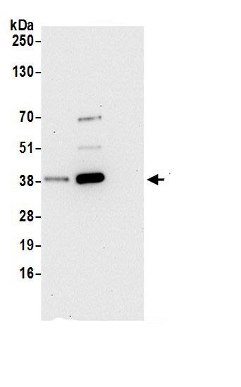 IDH3B Antibody