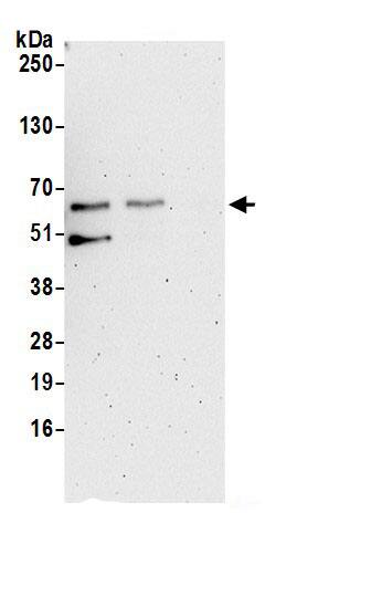 Syntrophin beta 1 Antibody