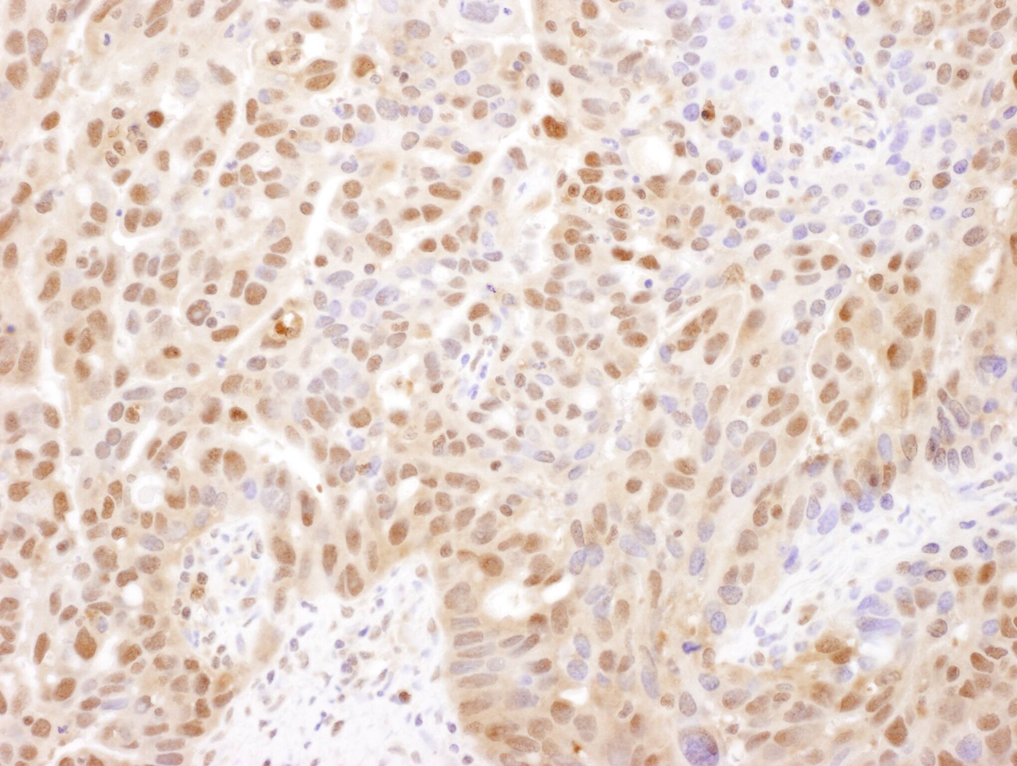 PSMA2 Antibody