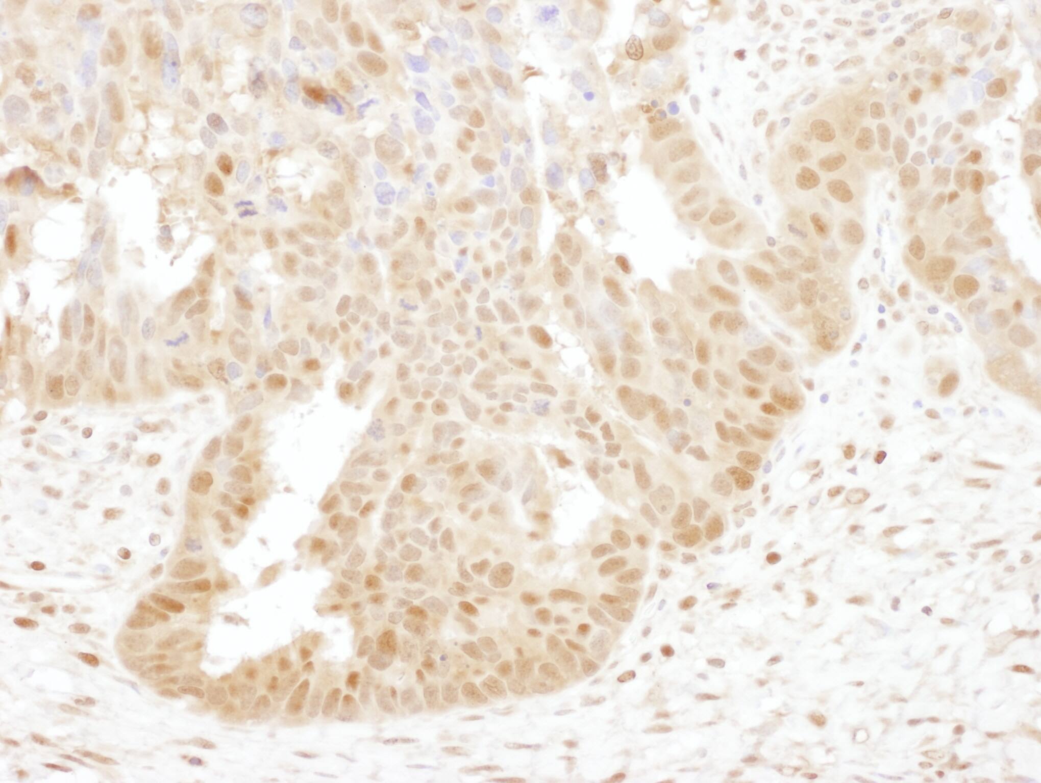 Proteasome subunit beta type 4 Antibody