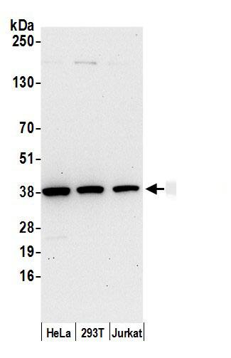 AKR1B1 Antibody