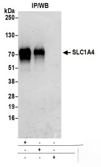 SLC1A4 Antibody