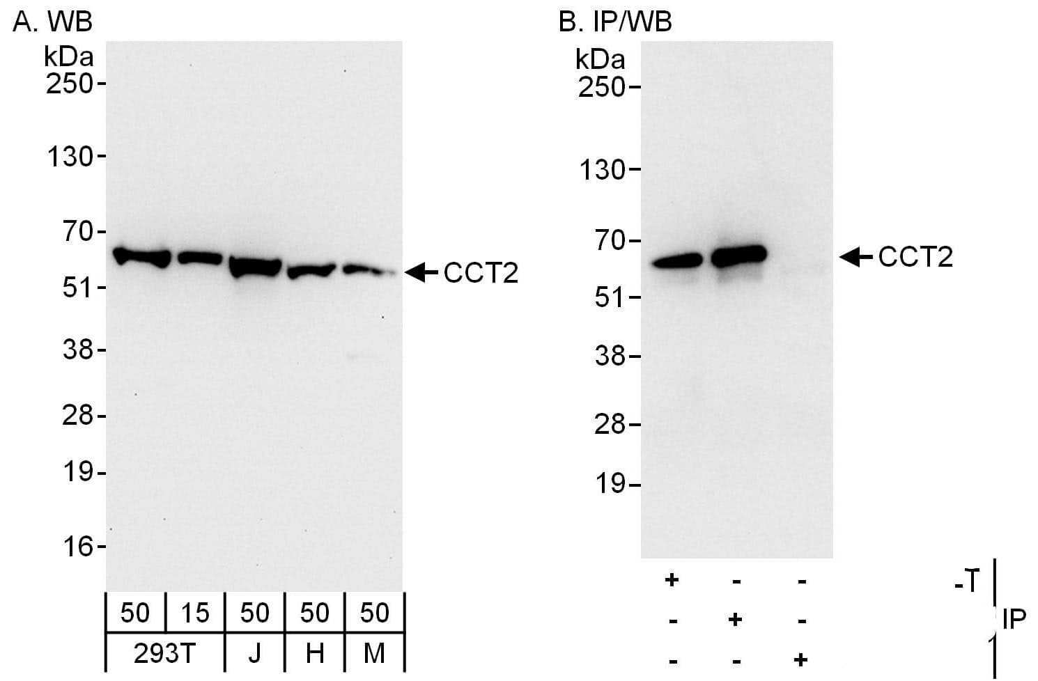 TCP1-beta Antibody