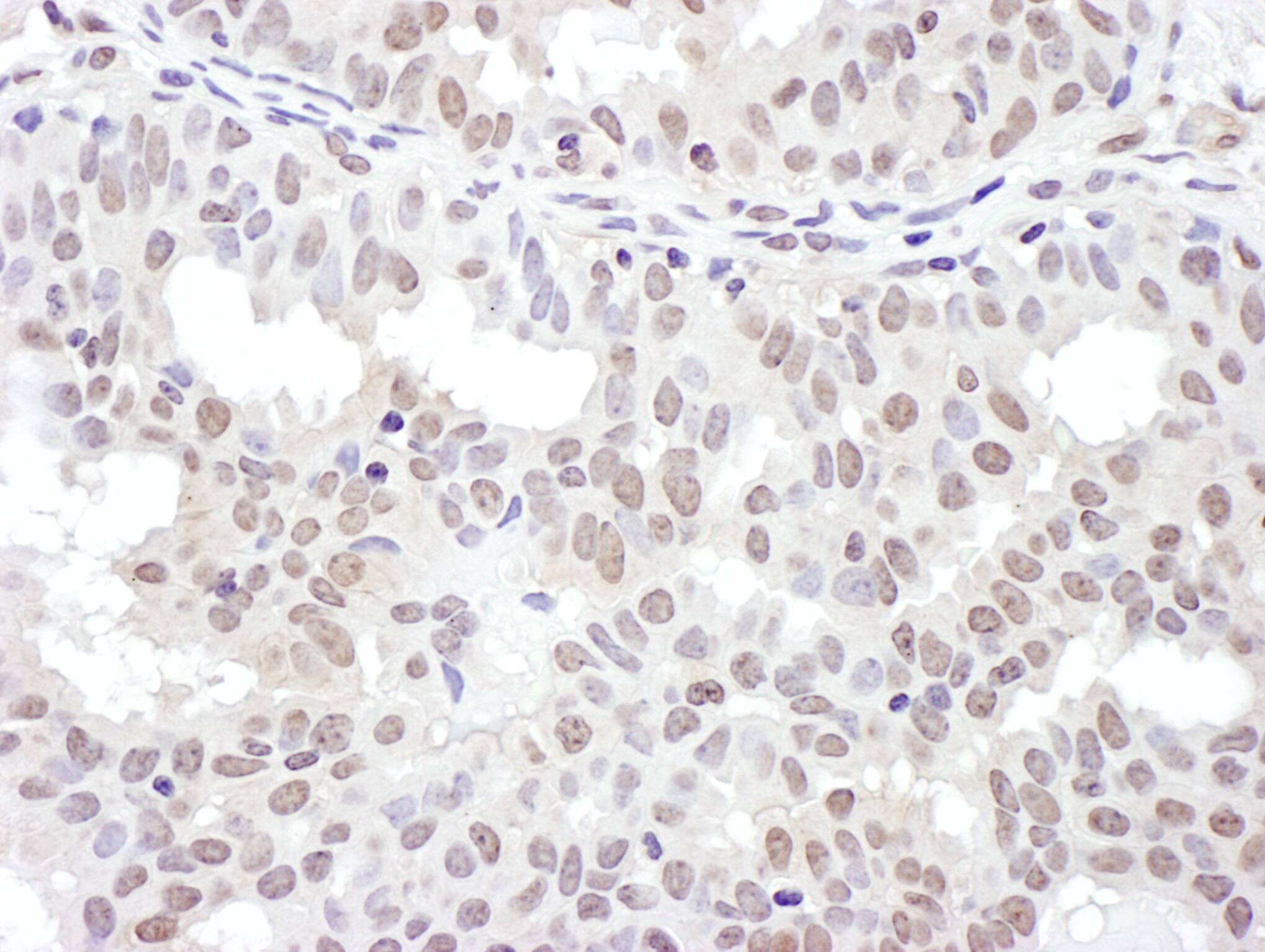 NKRF Antibody