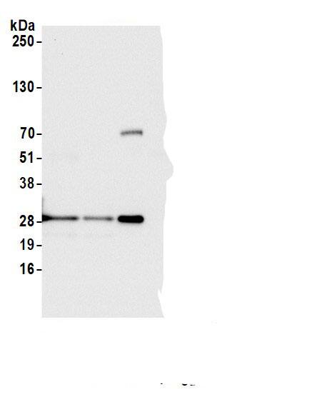 D4-GDI/RhoGDI2 Antibody