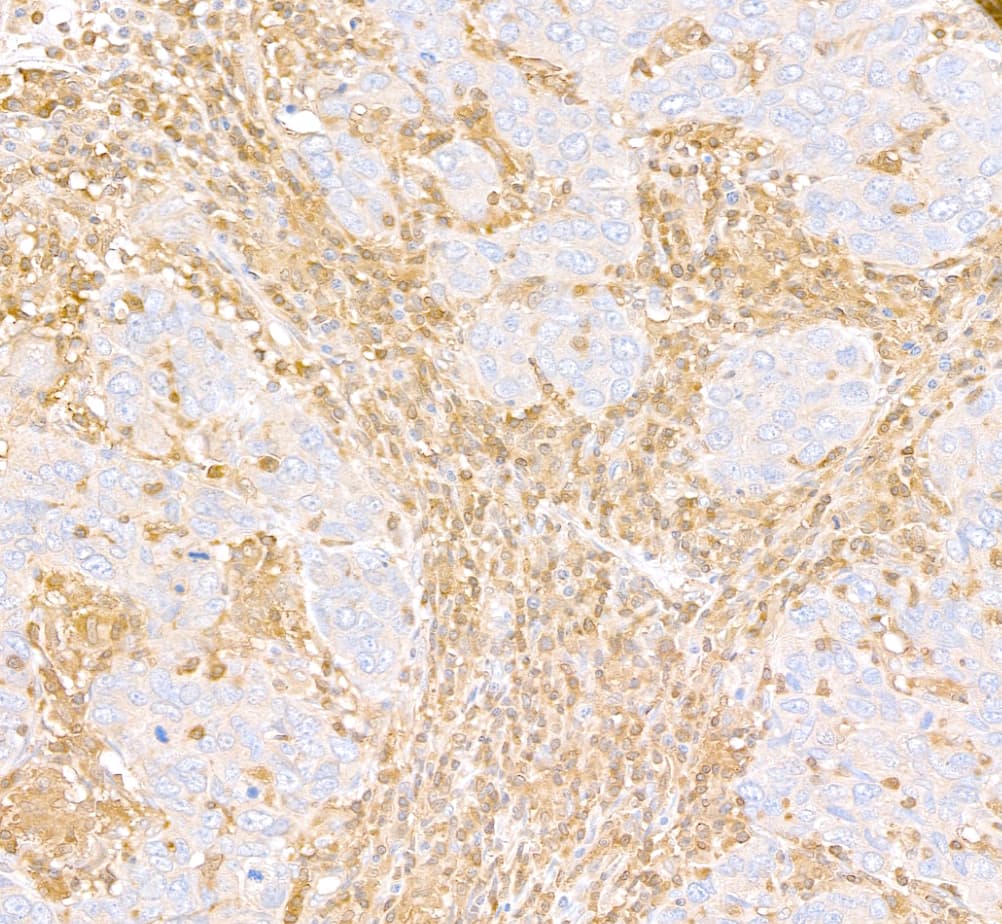 D4-GDI/RhoGDI2 Antibody