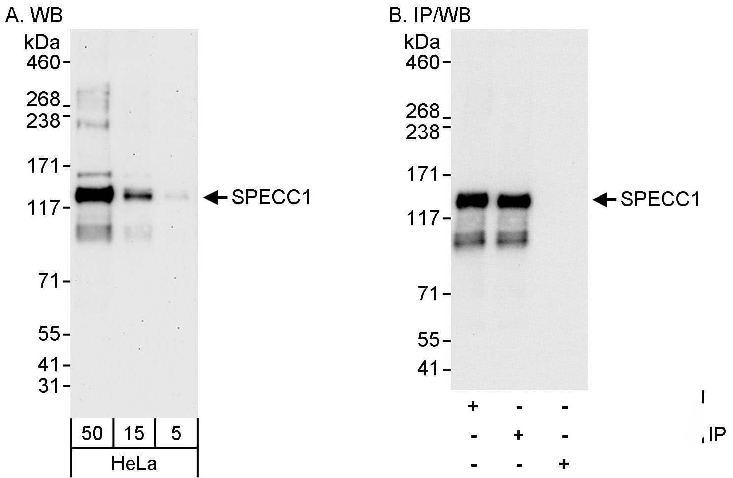 NSP 5 alpha 3 alpha Antibody