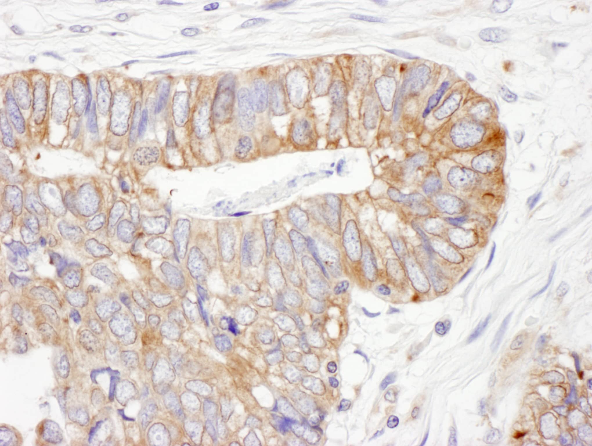 PDIA6 Antibody