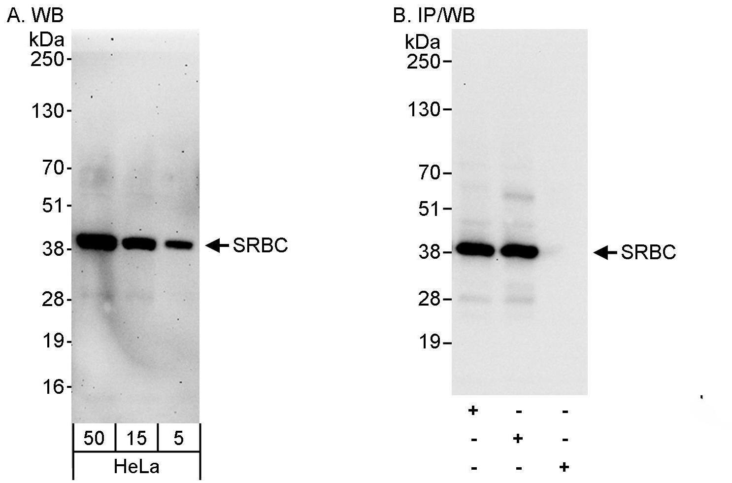 PRKCDBP Antibody